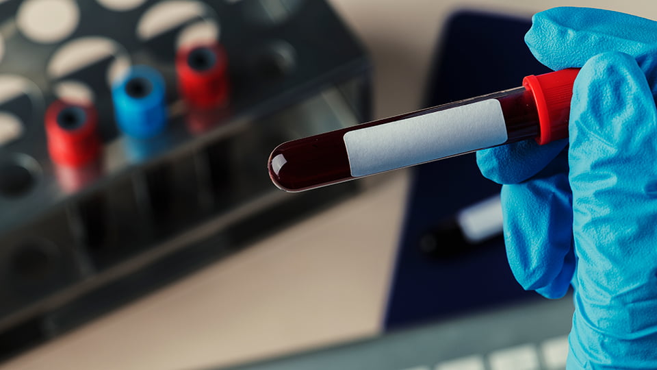 Nucleic Acid Extraction Importance