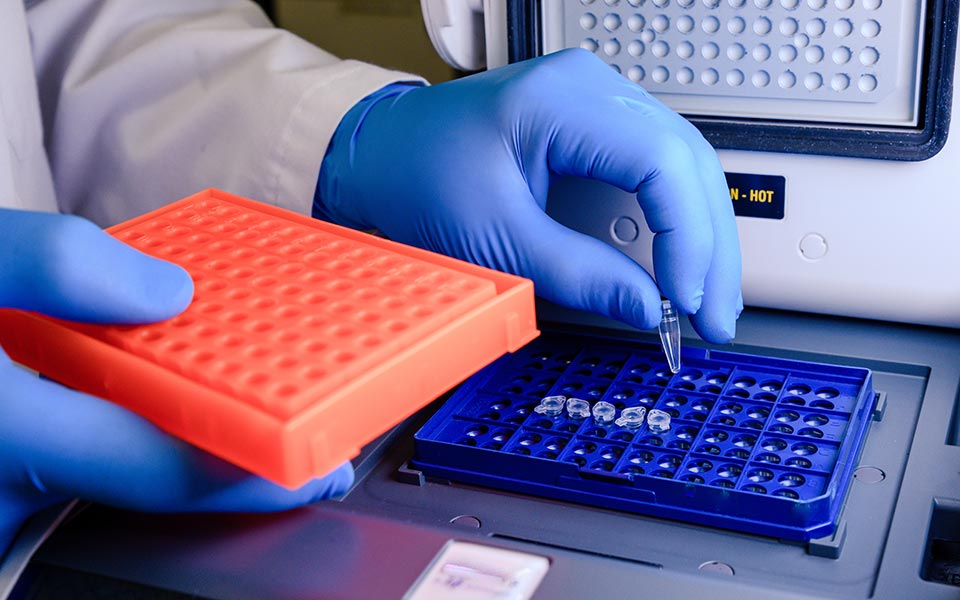Nucleic Acid Extraction Importance &mdash;